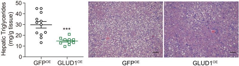 过表达GLUD1,脂肪肝改善 过表达GLUD1,脂肪肝改善