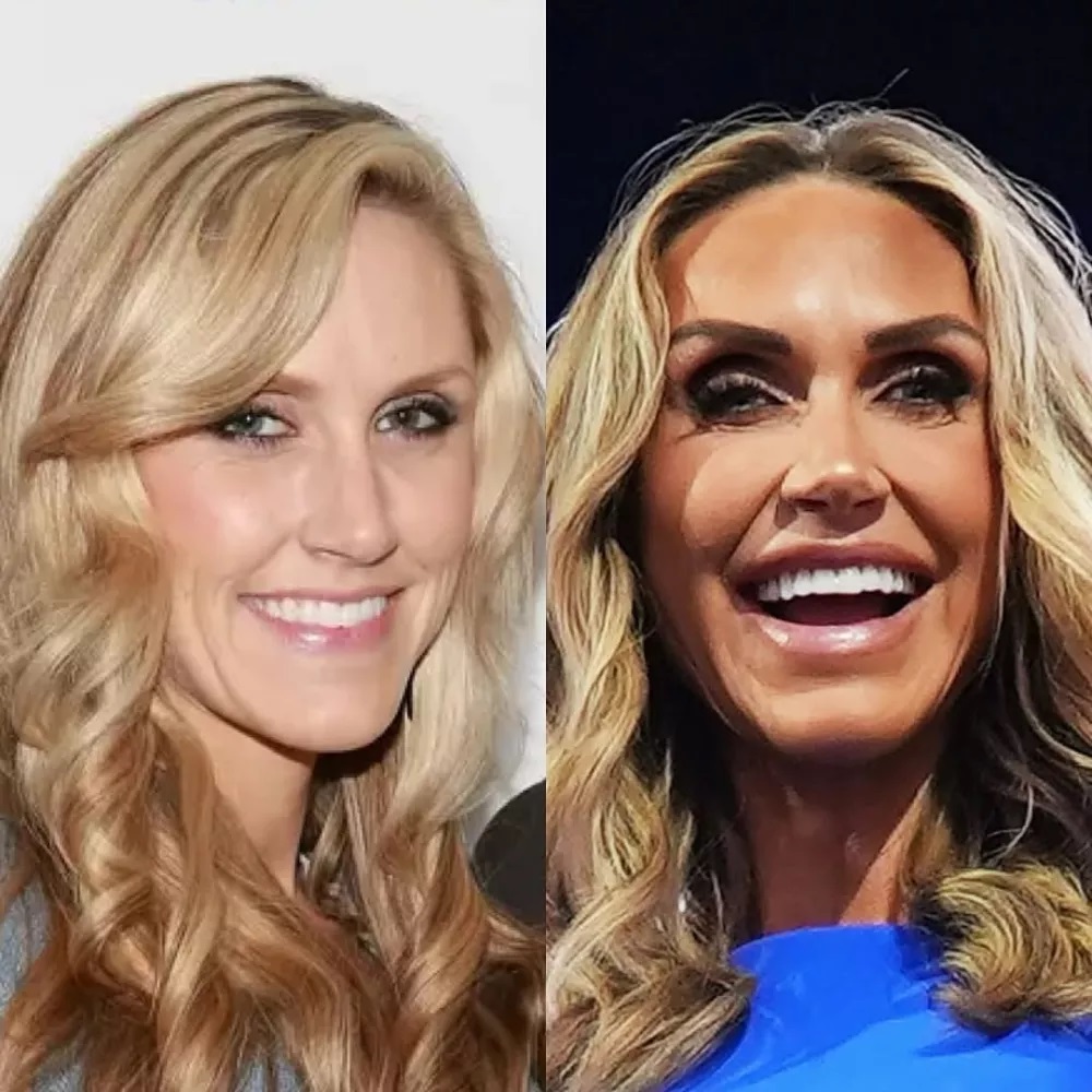 海湖庄园脸 海湖庄园脸