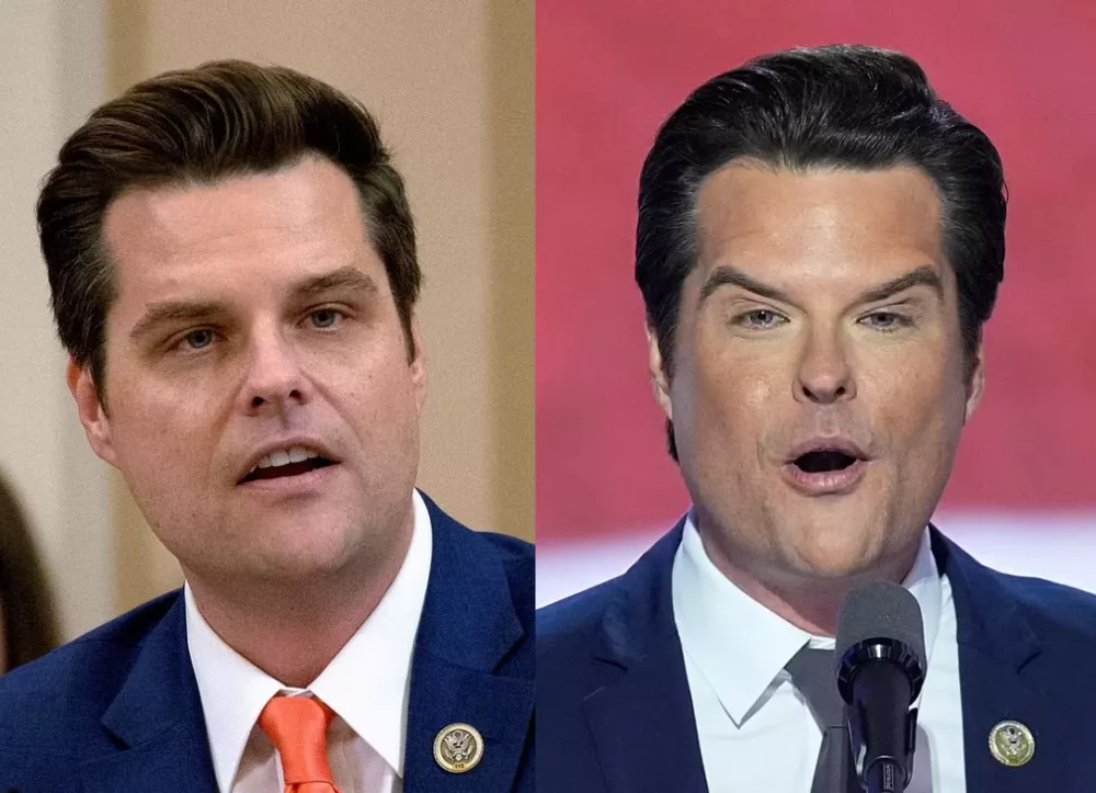 前美国众议员马特·盖茨 (Matt Gaetz)就曾在去年因明显的容貌改变而引发过争议 ... 前美国众议员马特·盖茨 (Matt Gaetz)就曾在去年因明显的容貌改变而引发过争议 ...
