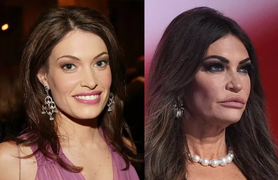 海湖庄园脸 海湖庄园脸