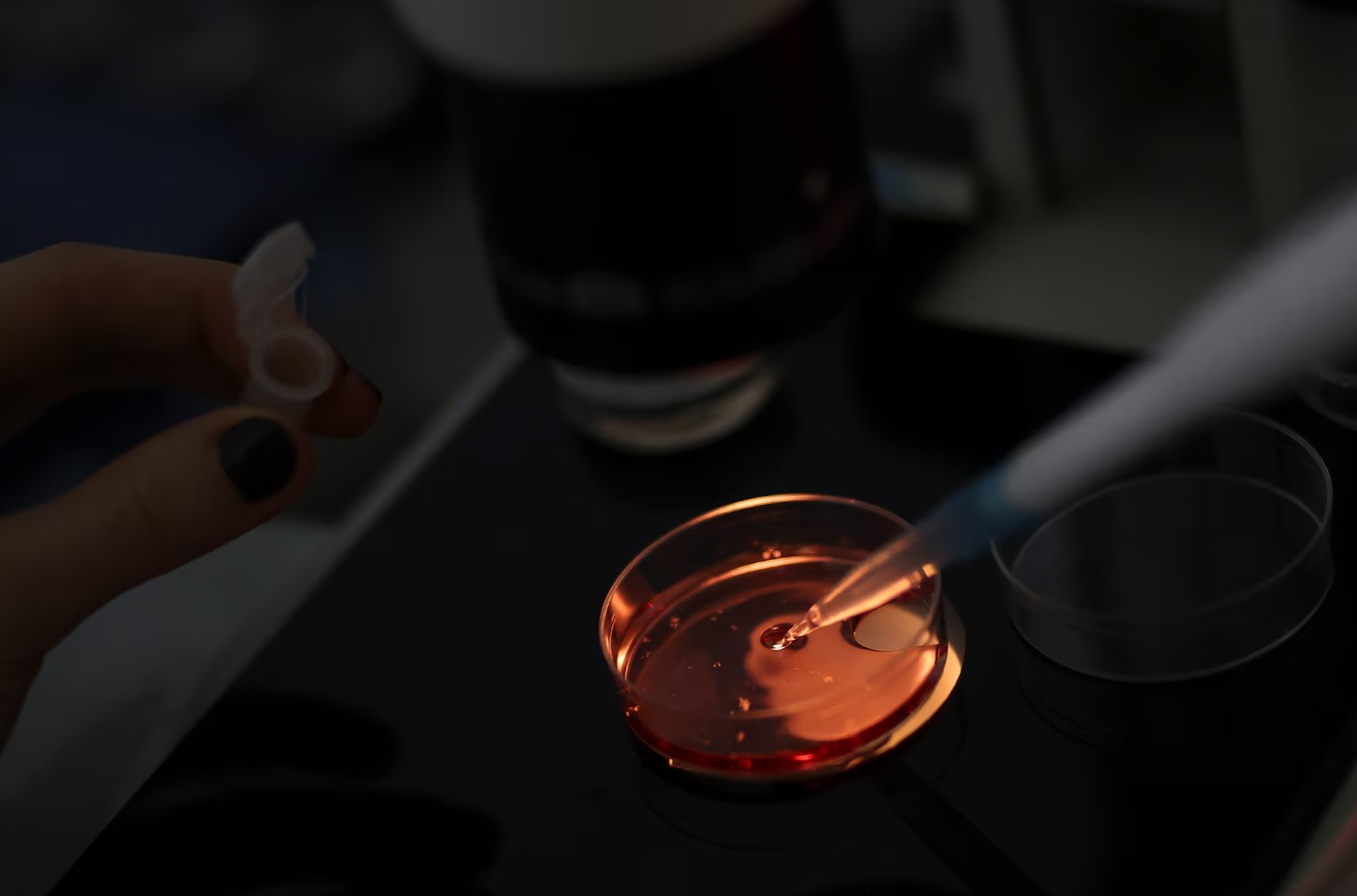 Kheiron Biotech 公司的一名员工在位于布宜诺斯艾利斯皮拉尔的实验室里,对马匹正在发育的卵子或卵母细胞进 ... Kheiron Biotech 公司的一名员工在位于布宜诺斯艾利斯皮拉尔的实验室里,对马匹正在发育的卵子或卵母细胞进 ...